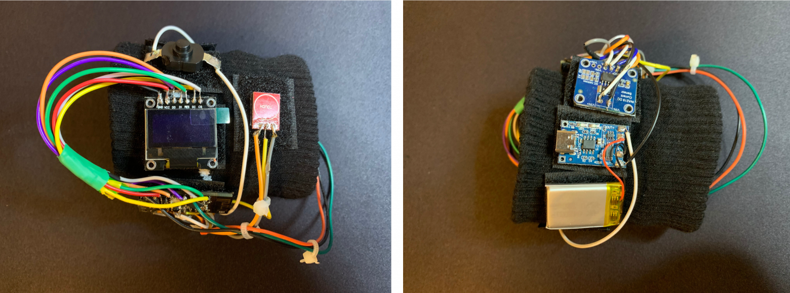 Собранное устройство SmartPulse